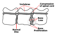 Image of Spine